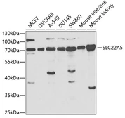 Anti-SLC22A5 antibody used in Western Blot (WB). GTX55800