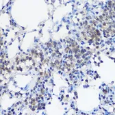 Anti-UBE2I antibody used in IHC (Paraffin sections) (IHC-P). GTX55830