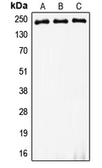 Anti-MYH8 antibody used in Western Blot (WB). GTX55871