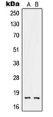 Anti-RNASE3 antibody used in Western Blot (WB). GTX55887