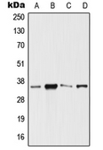 Anti-SIX3 antibody used in Western Blot (WB). GTX55892