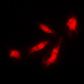 Anti-p35 antibody used in Immunocytochemistry/ Immunofluorescence (ICC/IF). GTX55905