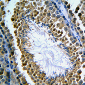 Anti-GANP antibody used in IHC (Paraffin sections) (IHC-P). GTX55906