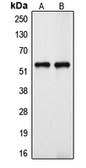 Anti-CYP39A1 antibody used in Western Blot (WB). GTX55953