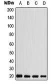 Anti-CABP5 antibody used in Western Blot (WB). GTX55964