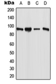 Anti-ESCO1 antibody used in Western Blot (WB). GTX55980