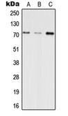 Anti-INPP5E antibody used in Western Blot (WB). GTX56011