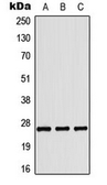 Anti-COL4A3 antibody used in Western Blot (WB). GTX56029