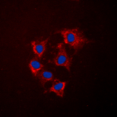 Anti-COL4A5 antibody used in Immunocytochemistry/ Immunofluorescence (ICC/IF). GTX56030