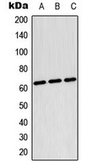 Anti-TESK2 antibody used in Western Blot (WB). GTX56036