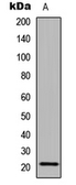 Anti-CALML6 antibody used in Western Blot (WB). GTX56051