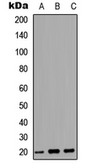 Anti-MARCKSL1 antibody used in Western Blot (WB). GTX56062