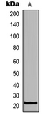 Anti-RHOXF1 antibody used in Western Blot (WB). GTX56069