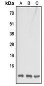 Anti-COX7B antibody used in Western Blot (WB). GTX56091