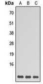 Anti-GNG5 antibody used in Western Blot (WB). GTX56100