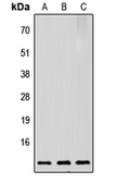 Anti-PTMA antibody used in Western Blot (WB). GTX56113