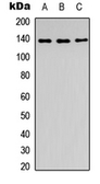 Anti-SLC4A7 antibody used in Western Blot (WB). GTX56119