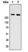 Anti-ZNF462 antibody used in Western Blot (WB). GTX56126