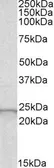 Anti-GPX2 antibody, Internal used in Western Blot (WB). GTX56140