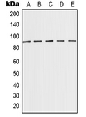 Anti-PCQAP / MED15 antibody used in Western Blot (WB). GTX56188