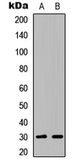 Anti-ATF5 antibody used in Western Blot (WB). GTX56217