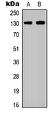 Anti-EphA2 antibody used in Western Blot (WB). GTX56226