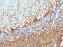 Anti-NF-H (phospho) antibody [NE14] used in IHC (Paraffin sections) (IHC-P). GTX57165