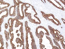 Anti-Cytokeratin 18 antibody [IHC018] used in IHC (Paraffin sections) (IHC-P). GTX57172
