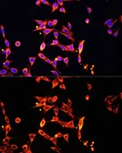 Anti-Heparanase 1 antibody used in Immunocytochemistry/ Immunofluorescence (ICC/IF). GTX57224