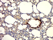Anti-Uteroglobin antibody used in IHC (Paraffin sections) (IHC-P). GTX57228