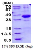 Human SPSB2 protein, His tag. GTX57243-pro
