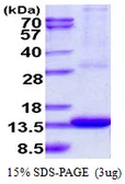 Human ARL9 protein, His tag. GTX57334-pro