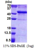 Human UPRT protein, His tag. GTX57343-pro
