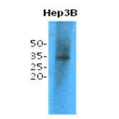 Anti-TPMT antibody [AT2E7] used in Western Blot (WB). GTX57582