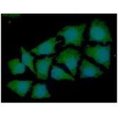 Anti-Syntrophin alpha 1 antibody [AT1E1] used in Immunocytochemistry/ Immunofluorescence (ICC/IF). GTX57590