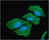 Anti-ACAT2 antibody [AT55D5] used in Immunocytochemistry/ Immunofluorescence (ICC/IF). GTX57610