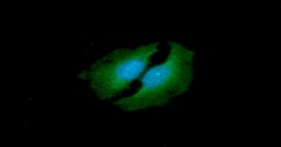 Anti-TIP30 antibody [AT5D6] used in Immunocytochemistry/ Immunofluorescence (ICC/IF). GTX57690