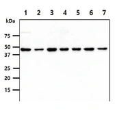 Anti-PSMD11 antibody [AT2C7] used in Western Blot (WB). GTX57692