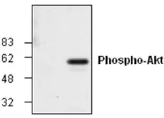 Anti-AKT (phospho Ser473) antibody used in Western Blot (WB). GTX59559