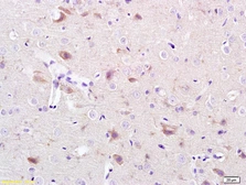 Anti-CACNA1G antibody used in IHC (Paraffin sections) (IHC-P). GTX60133