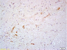 Anti-Prokineticin 2 antibody used in IHC (Paraffin sections) (IHC-P). GTX60189