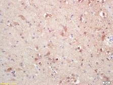 Anti-SOAT2 antibody used in IHC (Paraffin sections) (IHC-P). GTX60244