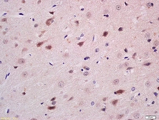 Anti-NGN3 antibody used in IHC (Paraffin sections) (IHC-P). GTX60254