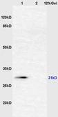 Anti-Fetuin A antibody used in Western Blot (WB). GTX60278