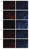 Anti-Histone H3K36me1 (Mono-methyl Lys36) antibody - ChIP grade used in Immunocytochemistry/ Immunofluorescence (ICC/IF). GTX60354