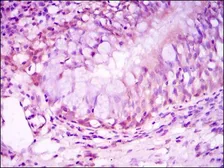 Anti-Glucocorticoid Receptor antibody [6E6] used in IHC (Paraffin sections) (IHC-P). GTX60389