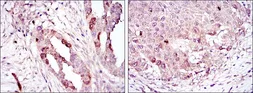 Anti-Aurora A antibody [4G10] used in IHC (Paraffin sections) (IHC-P). GTX60392