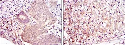 Anti-MEK6 antibody [3H12B9] used in IHC (Paraffin sections) (IHC-P). GTX60397