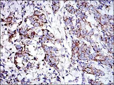 Anti-Prohibitin antibody [5H7] used in IHC (Paraffin sections) (IHC-P). GTX60495