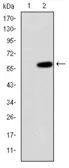 Anti-MEKK2 antibody [4B4] used in Western Blot (WB). GTX60504